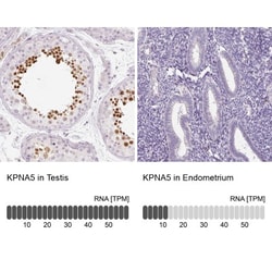 KPNA5 Antibody, Novus Biologicals 0.1mL; Unlabeled:Antibodies, Polyclonal